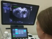 В женской консультации Рыбинской горбольницы № 1 появился ультразвуковой аппарат экспертного класса