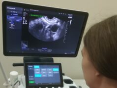 В женской консультации Рыбинской горбольницы № 1 появился ультразвуковой аппарат экспертного класса