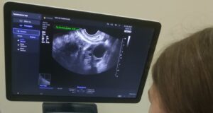 В женской консультации Рыбинской горбольницы № 1 появился ультразвуковой аппарат экспертного класса