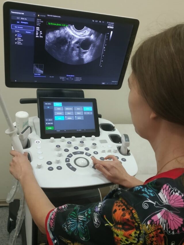 В женской консультации Рыбинской горбольницы № 1 появился ультразвуковой аппарат экспертного класса