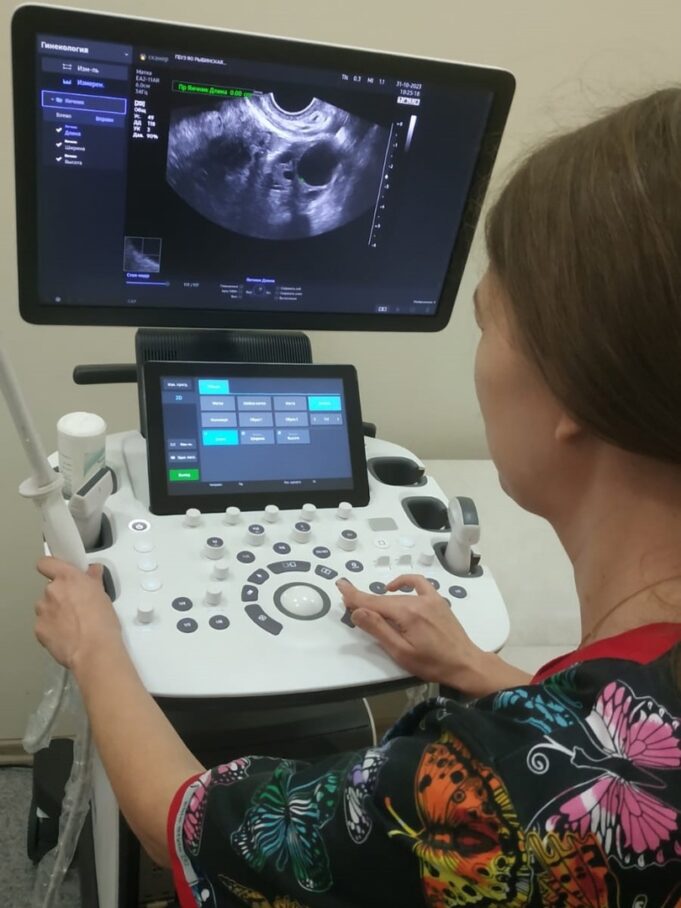 В женской консультации Рыбинской горбольницы № 1 появился ультразвуковой аппарат экспертного класса