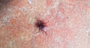 Рыбинск на втором месте в Ярославской области по активности клещей