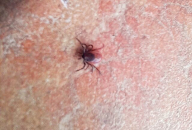 Рыбинск на втором месте в Ярославской области по активности клещей