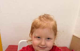 Маленькой Алине очень нужна наша помощь