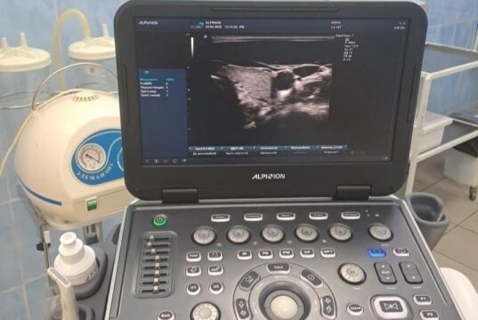 Три аппарата ультразвуковой диагностики поступили в клиническую больницу имени Н.В. Соловьева в Ярославле